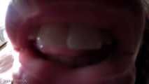 Mouth and Tongue Teaser