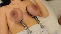 oil filters on breasts