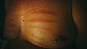 Nipple piercing with welts from a cane